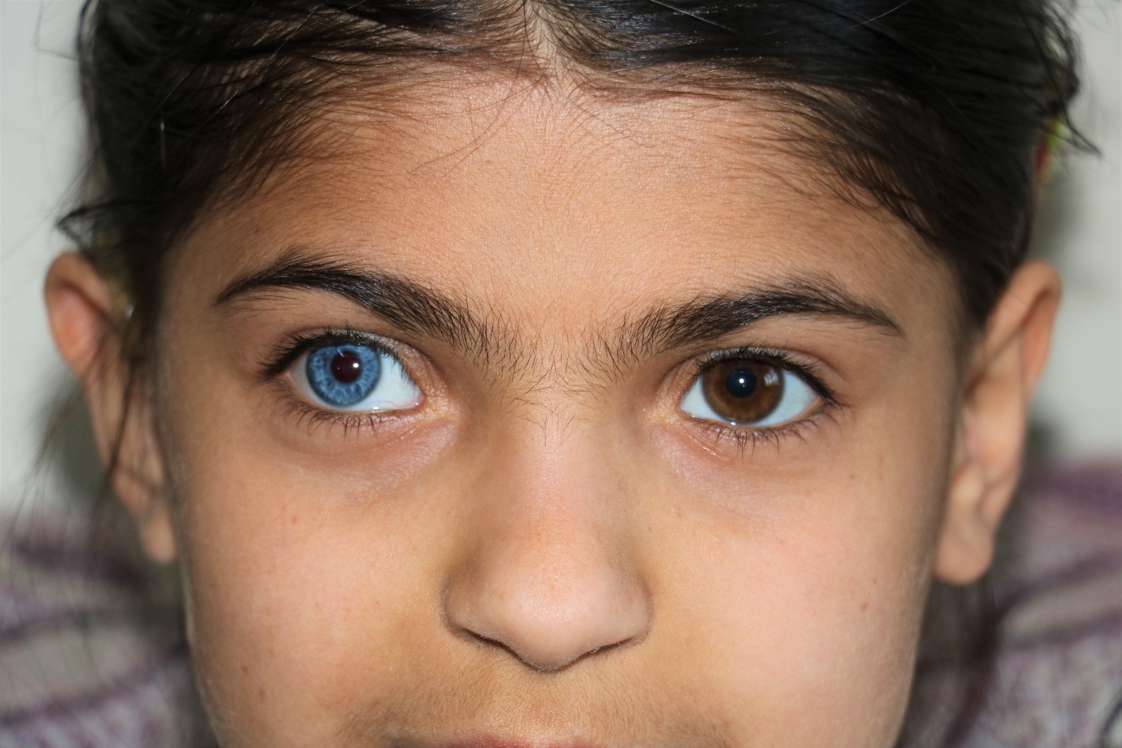 Yasin ve Elif kardeşler hayata çift renk bakıyor