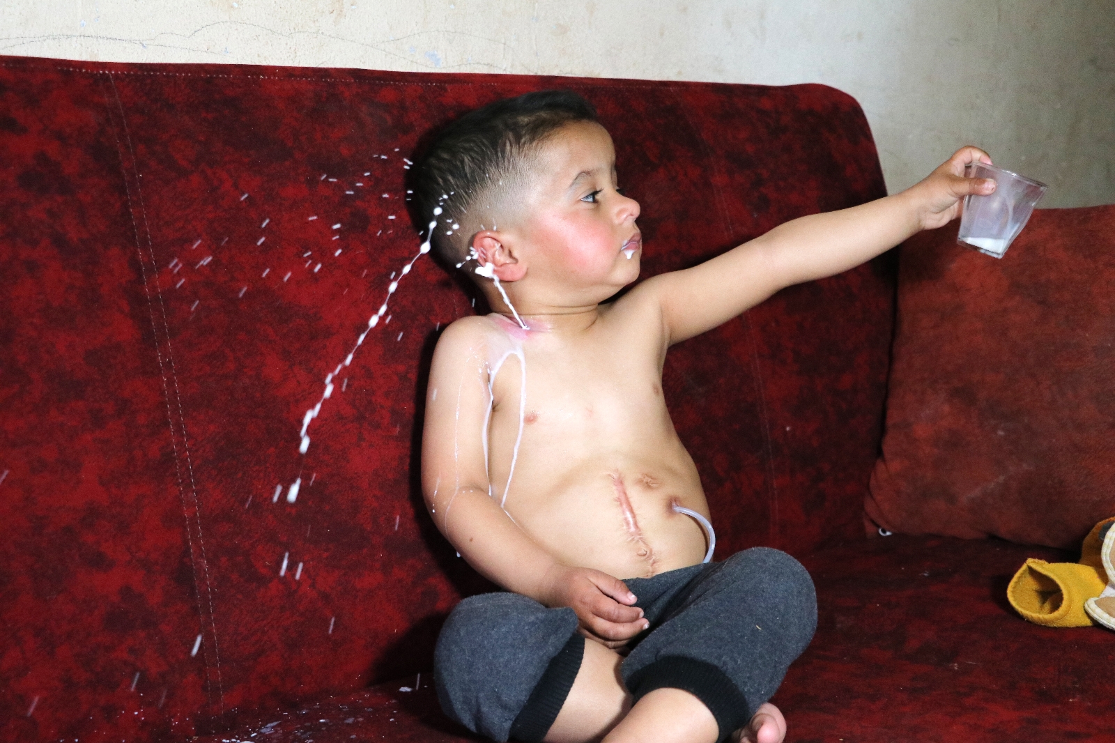 Yemek borusu olmayan Muhammed yardım bekliyor